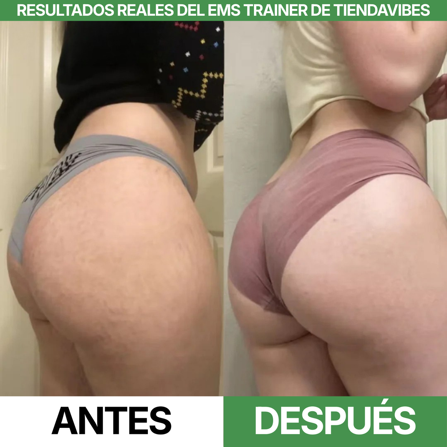 Entrenador EMS – Eleva y Tonifica tus Glúteos